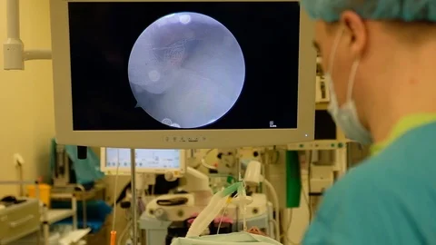 Surgeons perform arthroscopy of the patient, using modern endoscopic technology Stock Footage 90819708