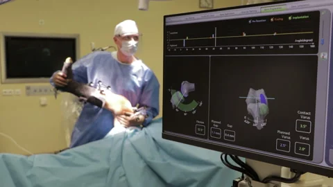 Surgeons perform the operation with a modern robot. Video stock 164118606