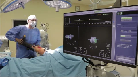 Surgeons perform the operation with a modern robot. Video stock 164118639