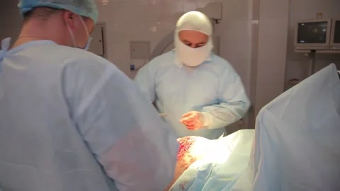 Surgeons perform an operation. the patient is under anesthesia. Video stock 135310150