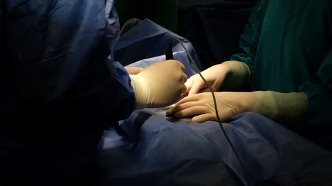 Surgeons perform a surgery Stock Footage 90819608