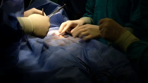 Surgeons perform a surgery Stock Footage 90819631