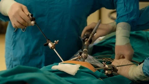 Surgeons perform a surgery Stock Footage 90819636