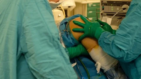 Surgeons perform a surgery Stock Footage 90819668