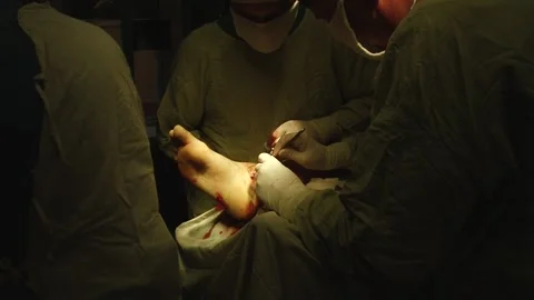 Surgeons perform surgery on the leg Stock Footage 130793929