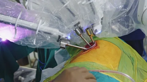 Surgeons perform surgery using a robot Video stock 225337147
