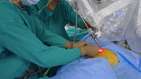 Surgeons perform surgery using a robot Stock Footage 225337187