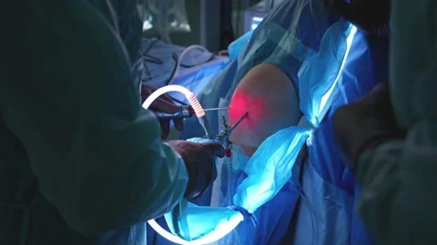 Surgeons Performing Arthroscopic Knee Surgery with Fiber Optic Tools and Ill 動画素材 296929846