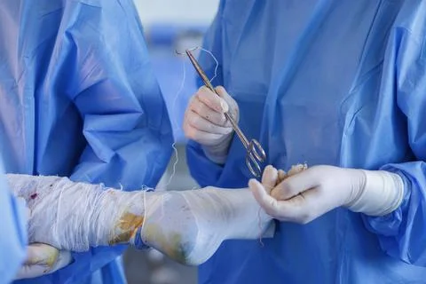 Surgeons Performing Complex Hip Replacement Surgery in Operating Room Stock Photos