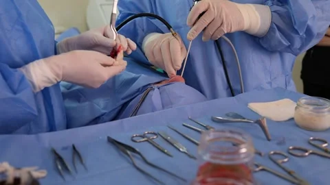 Surgeons performing endoscopic sinus surgery in operating room Video stock 316399093