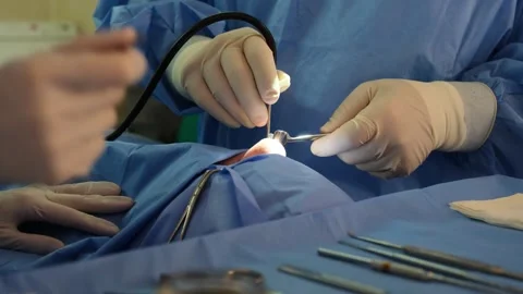 Surgeons performing endoscopic sinus surgery Video stock 316400183