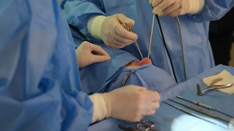 Surgeons performing endoscopic sinus surgery Stock Footage 316400511