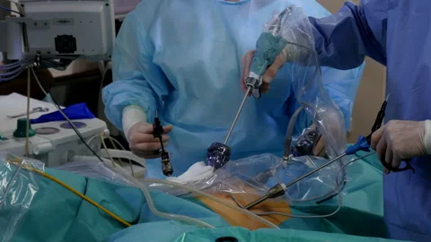 Surgeons performing laparoscopic surgery, camera moves to surgical instruments Stock Footage 107131057