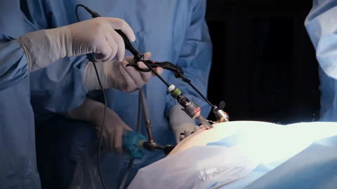Surgeons performing laparoscopic surgery using specialized instruments Stock Footage 306166902