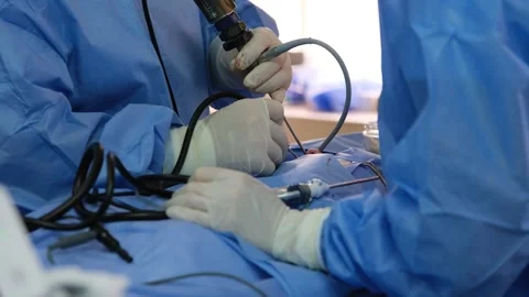 Surgeons performing laparoscopic surgery using specialized instruments Stock Footage 316399476