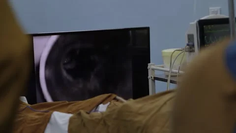 Surgeons performing laparoscopic surgery while monitoring the procedure on a Stock Footage 324782555