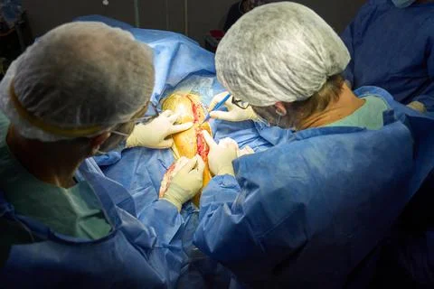 Surgeons performing a precise incision during surgery Stock Photos