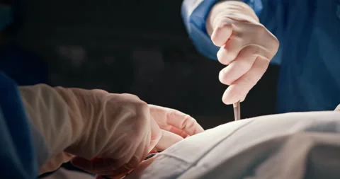 Surgeons performing a precise operation in modern surgical room Stock Footage 302716145