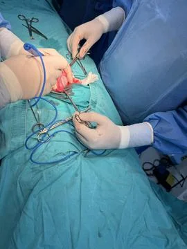 Surgeons Performing a Procedure with Surgical Instruments Stock Photos