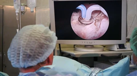 Surgeons performing prostate laser surgery. 스톡 동영상 56345142