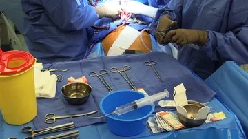 Surgeons preparing their equipment Stock Footage 85931525