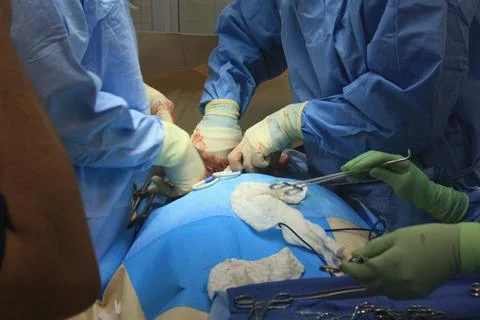 Surgeons put hands inside patient Stock-Fotos