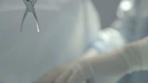 Surgeons team does complicated operation in room closeup of hand in frame and Stock Footage 117692667