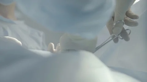 Surgeons team does complicated operation in room closeup of hand in frame and Stock Footage 117693015