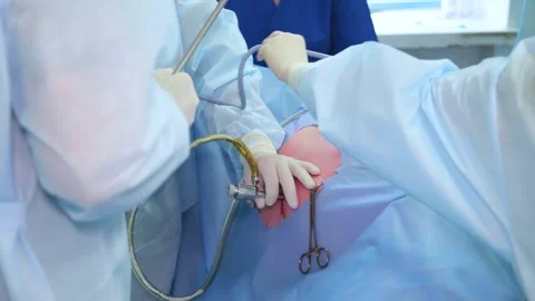 Surgeons team hands during laparoscopic abdominal operation. Stock Footage 245610122