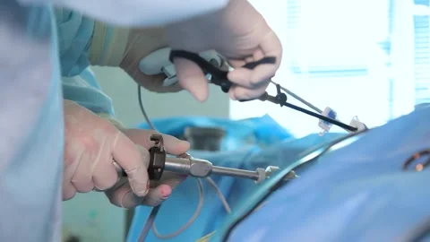 Surgeons team hands during laparoscopic abdominal operation. Stock Footage 245610126