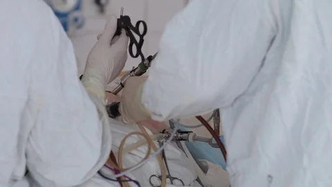 Surgeons team working. Close-up laparoscopic surgery. 스톡 동영상 80967784