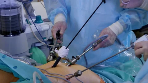 Surgeons teamwork performing laparoscopic surgery Vídeo Stock 111718057