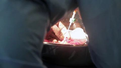 Surgery 6 Stock Footage 123669406