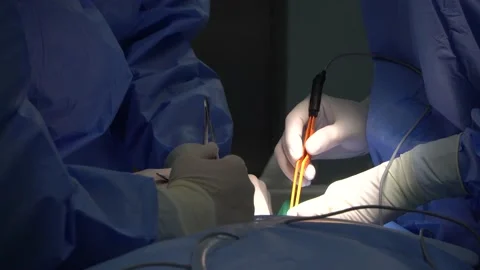 Surgery and Bipolar Forceps performed in the hospitals Stock Footage 239770297