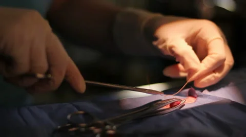 Surgery Stock Footage 1014836