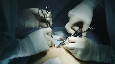 Surgery Stock Footage 90552478