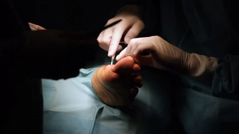 Surgery Stock Footage 107678421