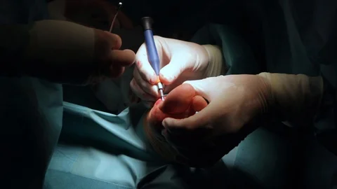 Surgery Stock Footage 107678561
