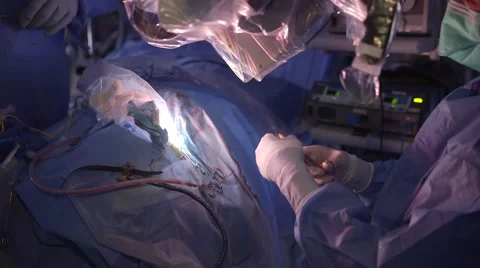 Surgery hand off Stock Footage 49549176