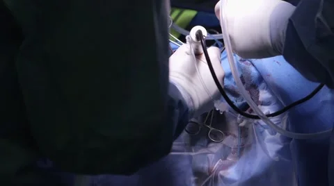 Surgery, hands close up Stock Footage 49549218