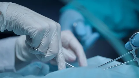 Surgery hands performing operation. Surgery hands at medical operation Stock Footage 95338953