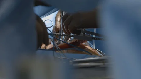 Surgery hands in white gloves perform medical operation by sterile instruments Stock Footage 102221377