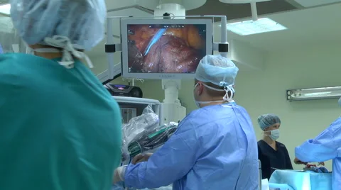 Surgery on the heart. Stock Footage 68143864