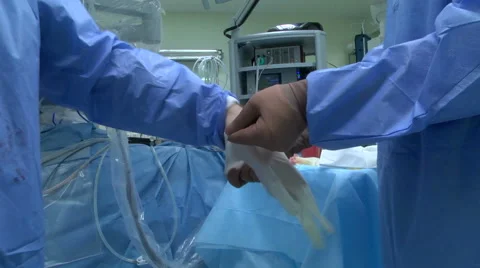 Surgery on the heart. Stock Footage 68143912