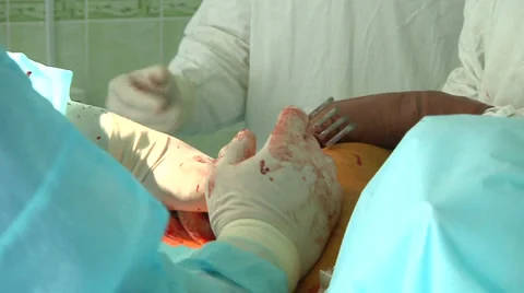 Surgery in a hospital 5 Stock-Footage 33291788
