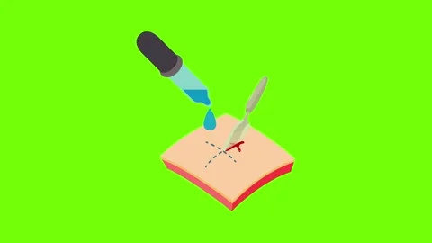 Surgery icon animation Stock Footage 152577433