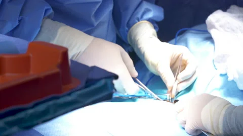 Surgery Instruments Pan Right Stock Footage 171141172