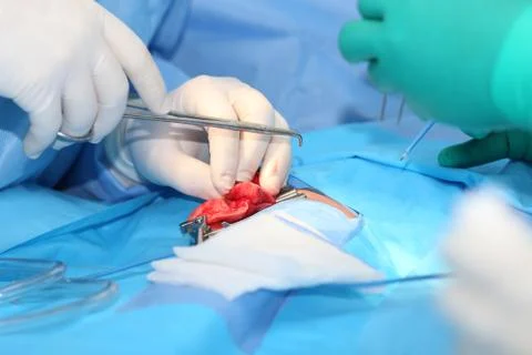 Surgery on a lung of an infant Stock Photos