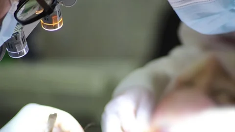 Surgery with microscope glasses, neurosurgery. Stock Footage 253753207