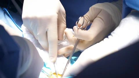 Surgery with Multiple Hands Using Instruments Stock Footage 171141353